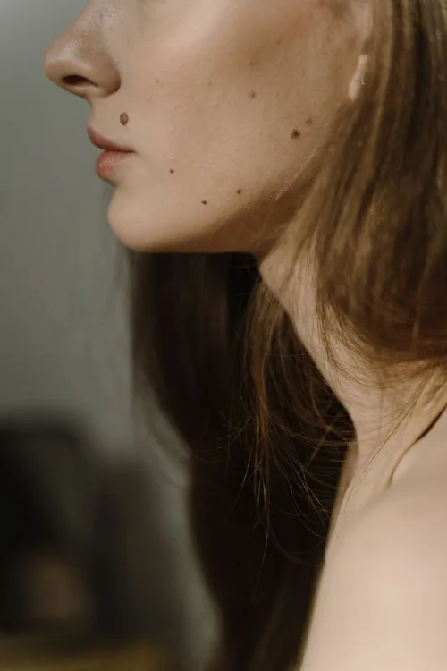 Skin brightening and analysis